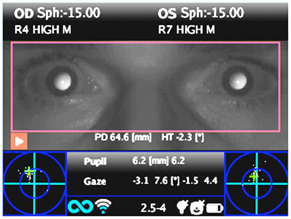 binocular monocular refraction 2win adaptica - us phthalmic
