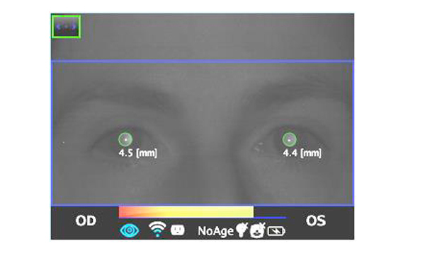 Dynamic Pupillometry Application DP App for 2WIN adaptica - us phthalmic