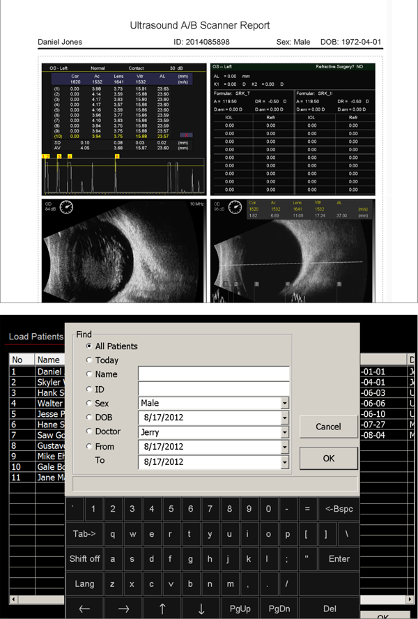 ultrasound eus-2600 ezer - us ophthalmic